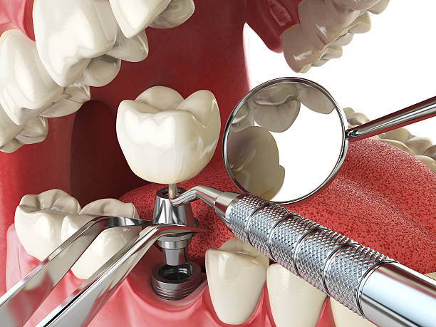 Emergency Dentist Open Today in NM